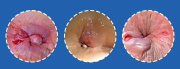 banner hỏi báo giá