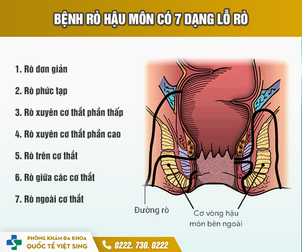 Chữa rò hậu môn như thế nào? Phương pháp điều trị không lo tái phát