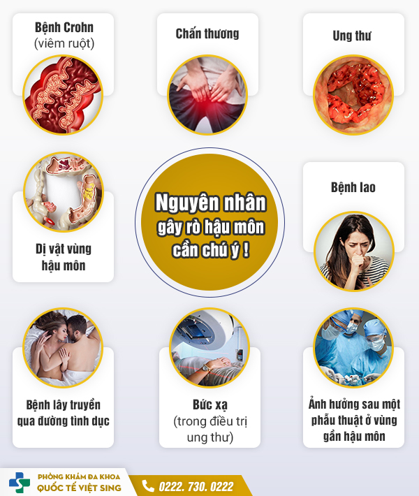 Top địa chỉ chữa rò hậu môn hiệu quả với chi phí hợp lí bạn nên biết