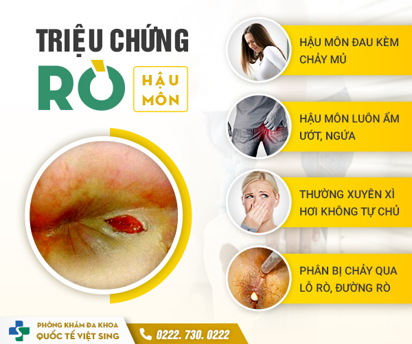 Các triệu chứng và biểu hiện tố cáo bạn đang bị rò hậu môn