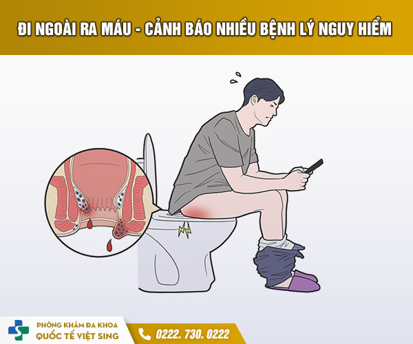 Kiến thức tổng quan về hiện tượng đại tiện ra máu!