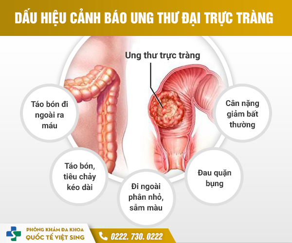 Bệnh Táo Bón Ra Máu Tươi – Chuyên Gia Cảnh Báo Nguy Hiểm