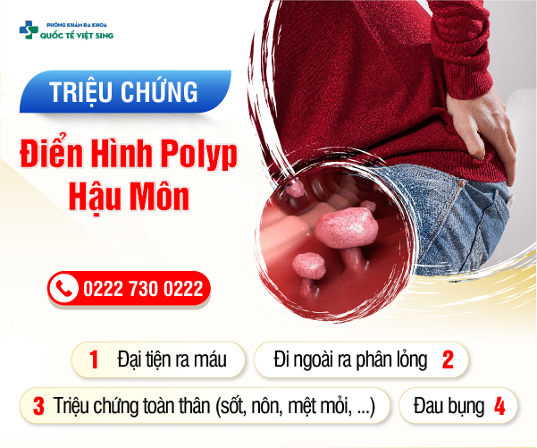 https://khambenhtribacninh.com/wp-content/uploads/2023/06/trieuchungpolyp.jpg