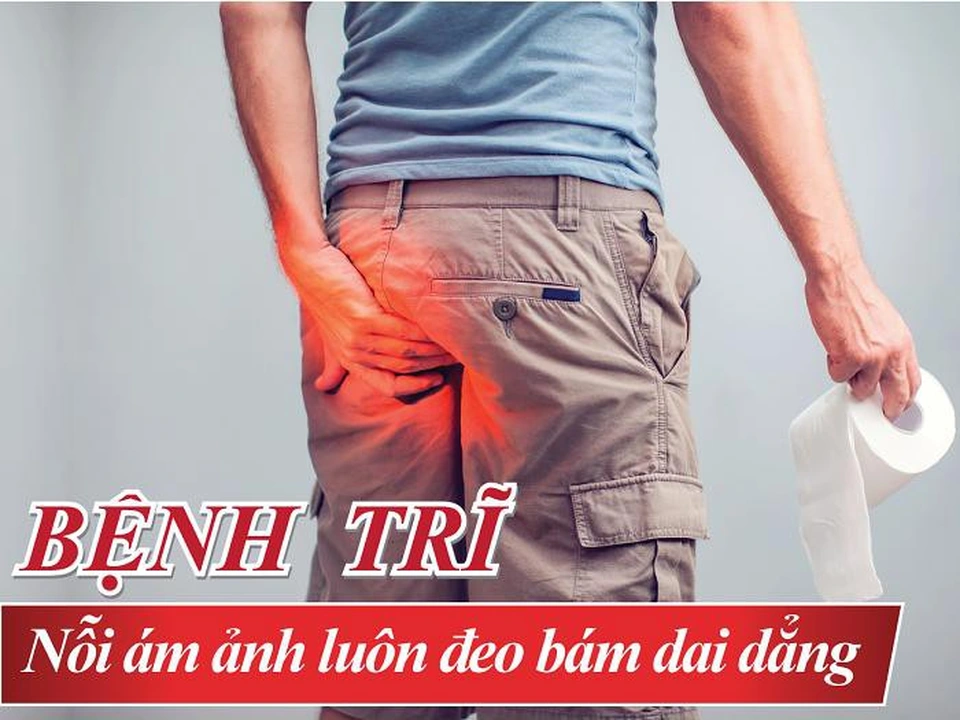 Tất tần tật những điều cần biết về bệnh trĩ mà người bệnh cần nắm rõ