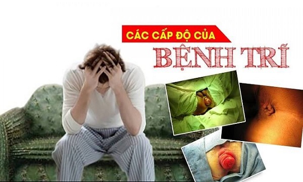 https://khambenhtribacninh.com/wp-content/uploads/2025/08/cac-cap-do-cua-benh-tri.jpg