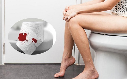 Đi ngoài ra máu – Cẩn thận dấu hiệu tiềm ẩn của UNG THƯ !