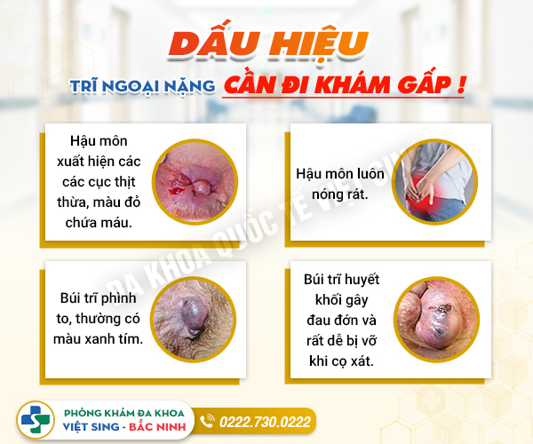 Mụn hậu môn: Nguyên nhân, dấu hiệu và cách điều trị hiệu quả